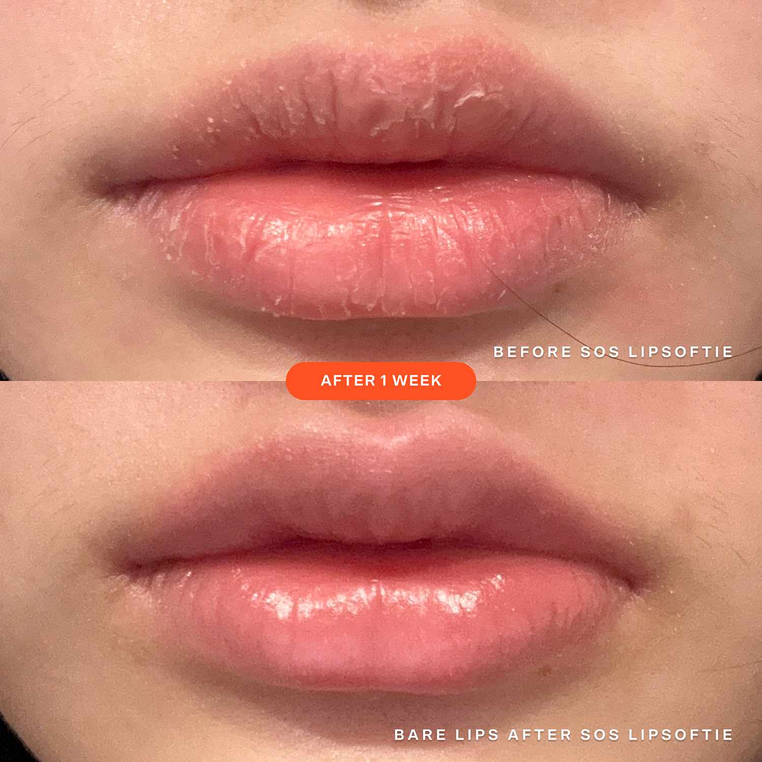 Before and After image of using Tower 28's new SOS lipsoftie