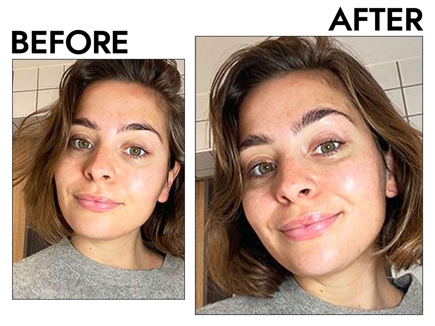 Person's face before and after using belif The True Cream Aqua Bomb