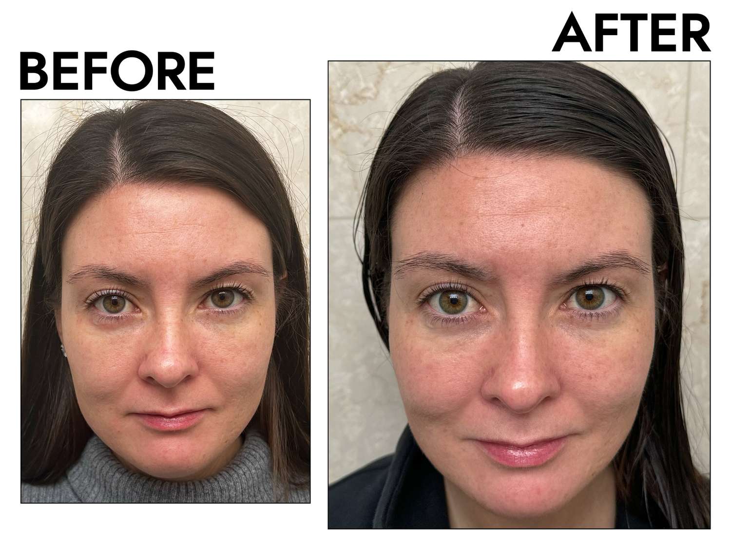 a tester before and after using CLINIQUE Smart Clinical Repairâ¢ Wrinkle Correcting Serum