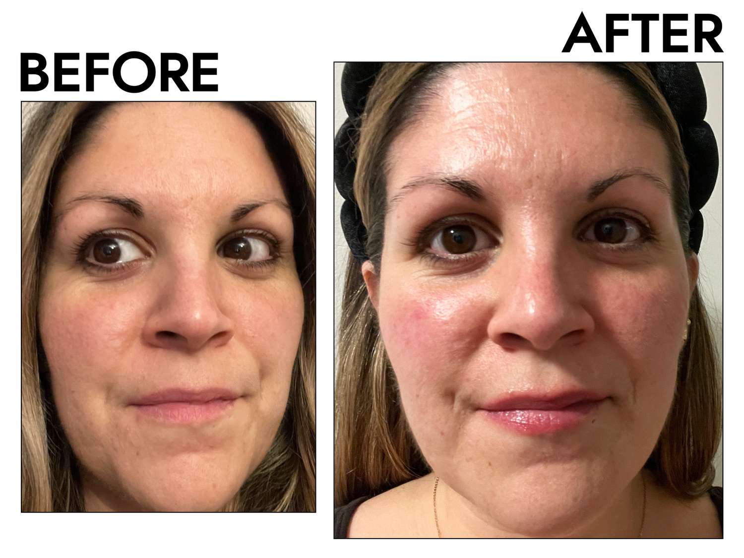 a tester before and after using Dr. Dennis Gross Advanced Retinol and Ferulic Texture Renewal Serum