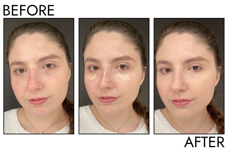 A person's face before, during, and after using the Tarte Shape Tape Full Coverage Concealer