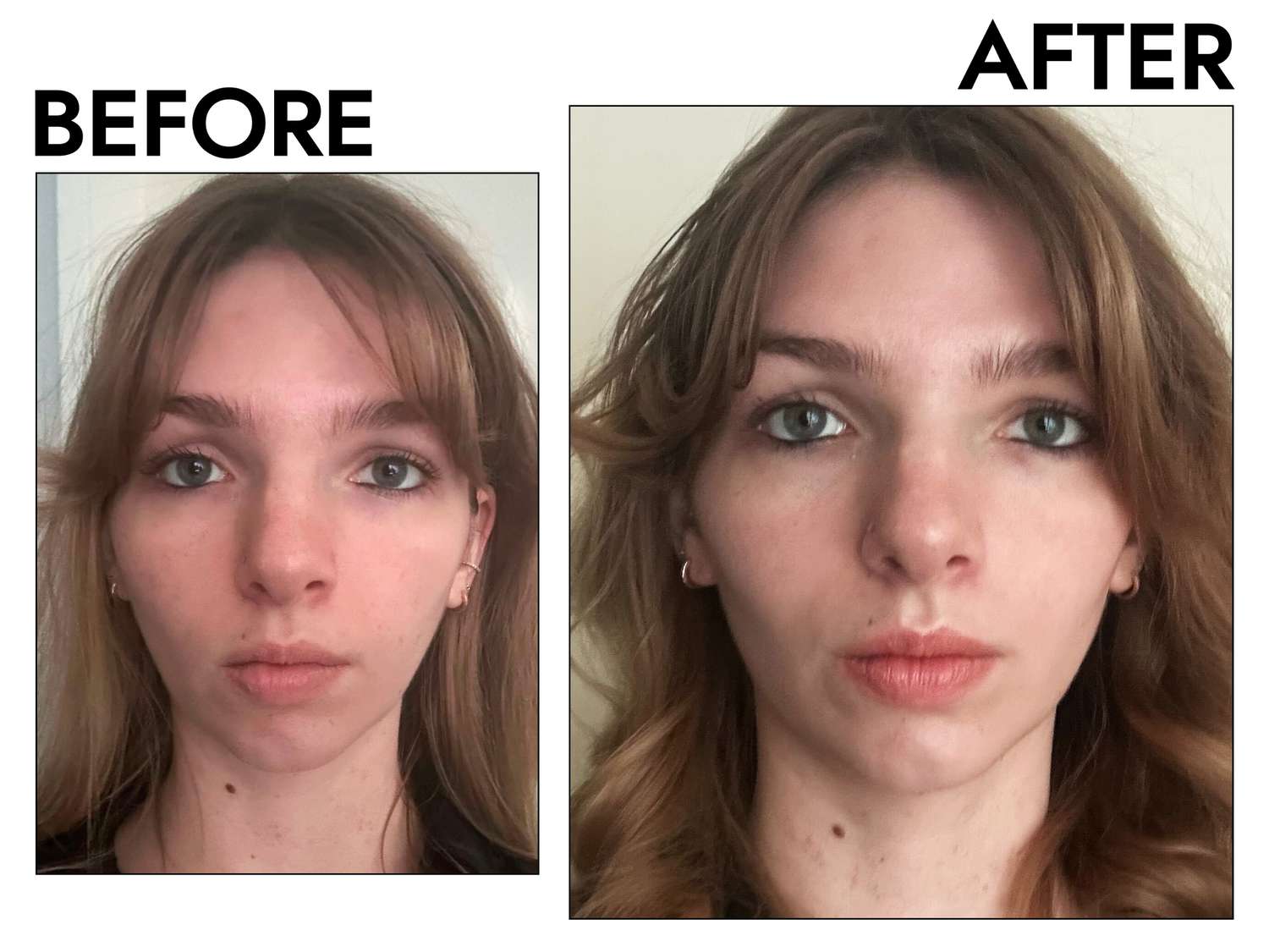 A person before and after applying Dr. Barbara Sturm The Better B Niacinamide Serum 