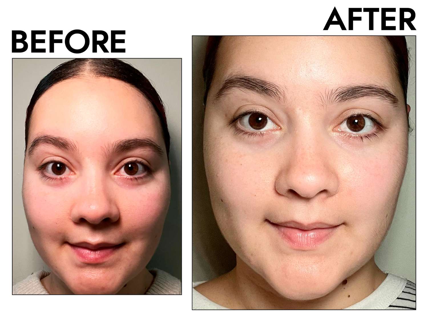 A person facing the camera before and after applying First Aid Beauty Facial Radiance Niacinamide Dark Spot Serum