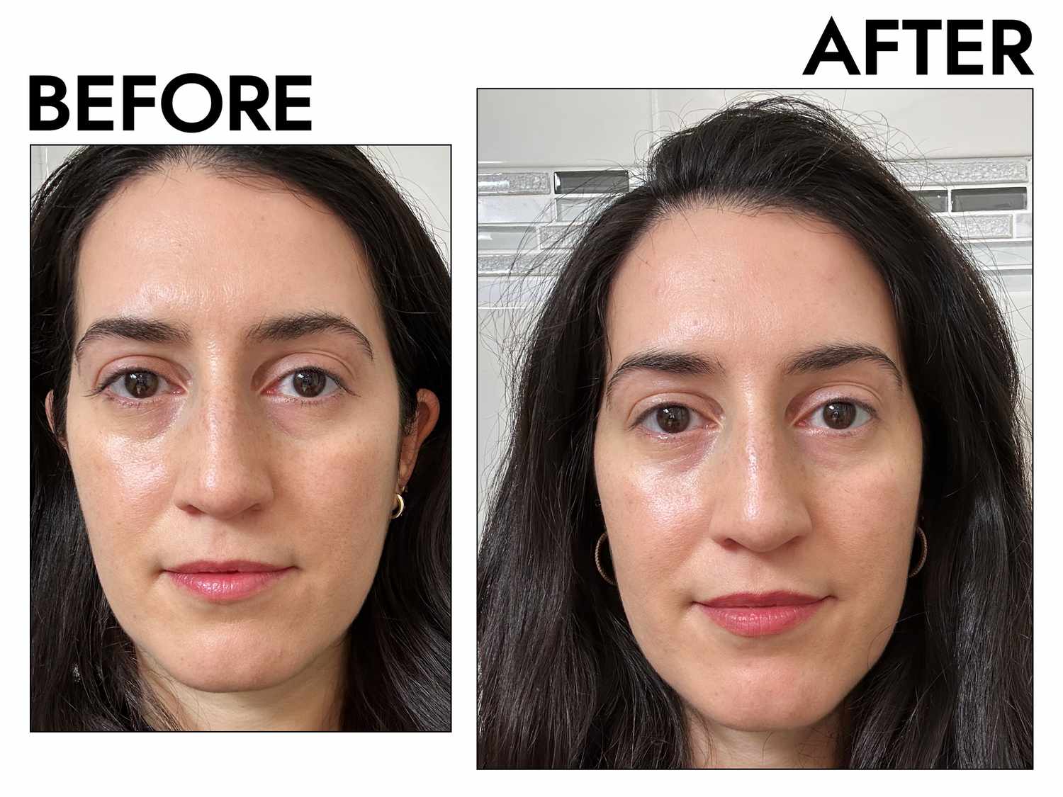 Before and after applying Glossier Super Pure Serum with Niacinamide + Zinc