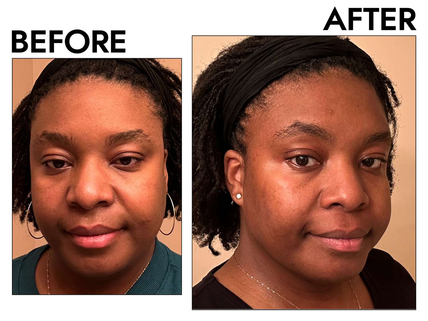 Before and after cleansing with the Fenty Skin Melt Awf Jelly Oil Makeup-Melting Cleanser