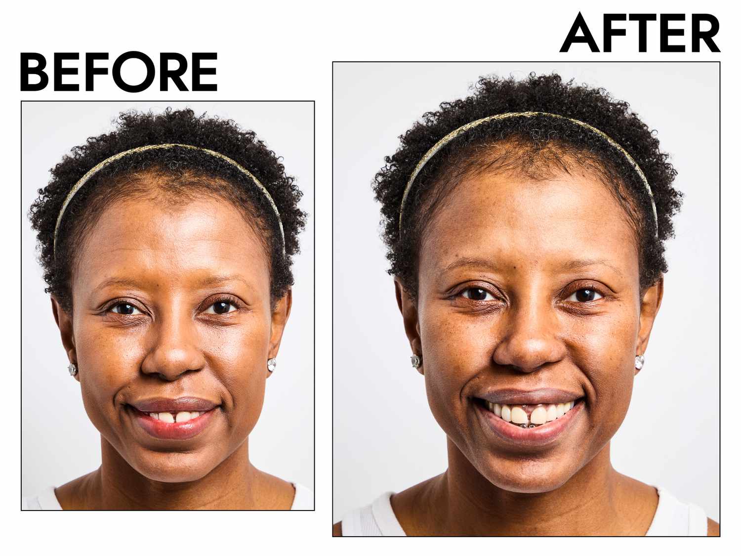 A person before and after cleansing their face with the Sulwhasoo Gentle Cleansing Oil