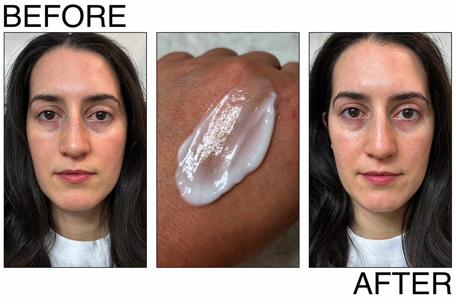 A person before and after applying Peter Thomas Roth Peptide Skinjection Moisture Infusion Refillable Cream to their face