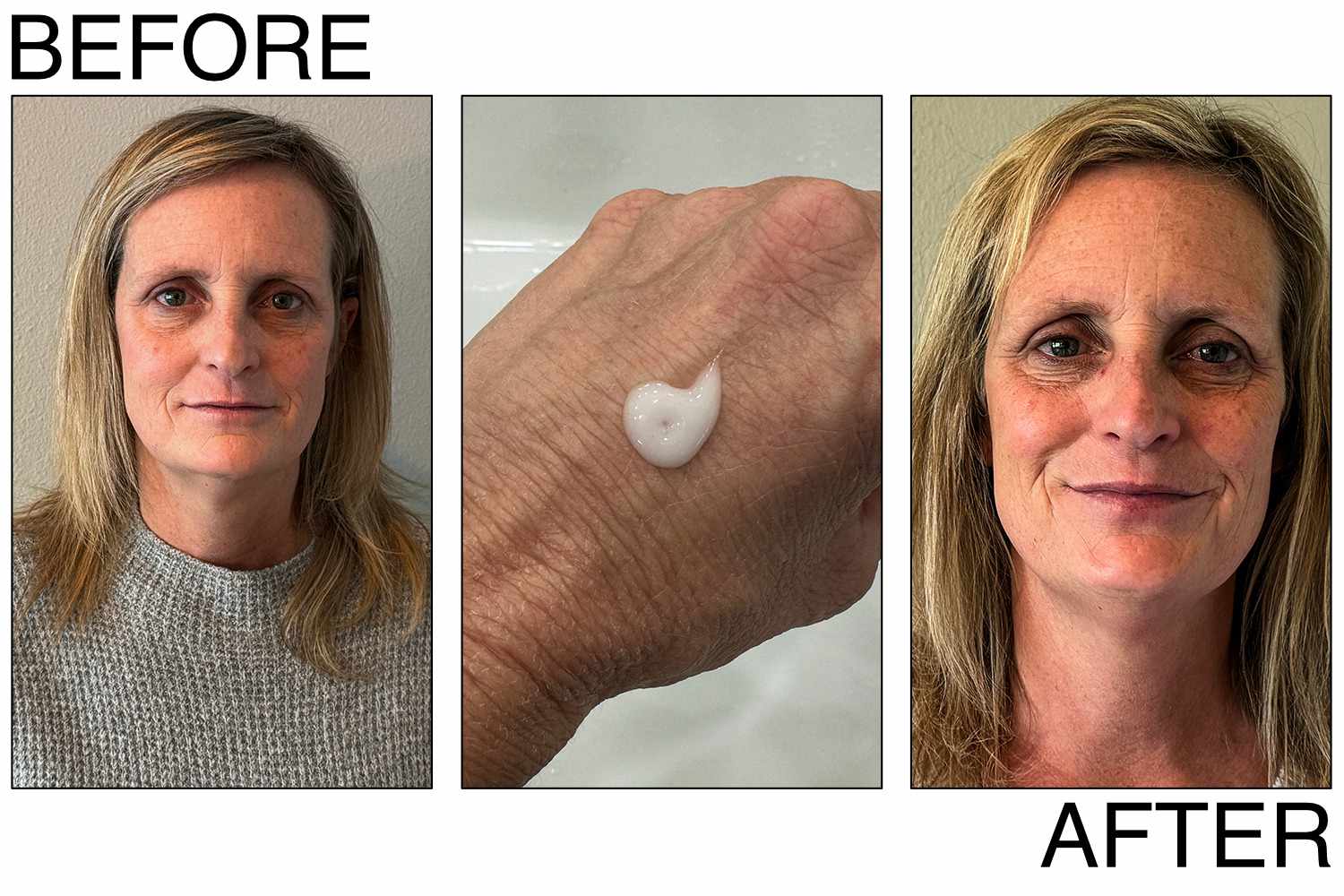 Before and after using the SkinMedica HA5 Rejuvenating Hydrator