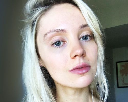 best prescription for acne - blonde woman