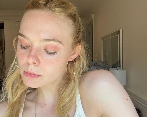 Elle Fanning with eczema on her eyelids