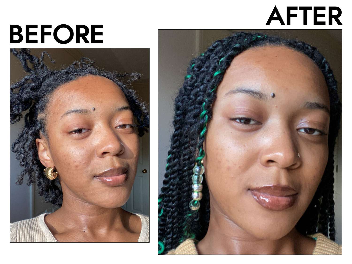 Person's face before and after using Mediheal Watermide Toner Pads