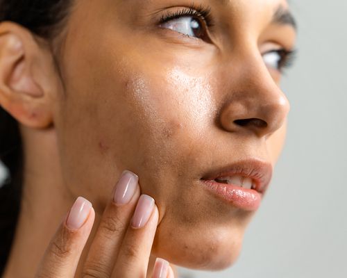 A woman applying cream to her face, her head to the side