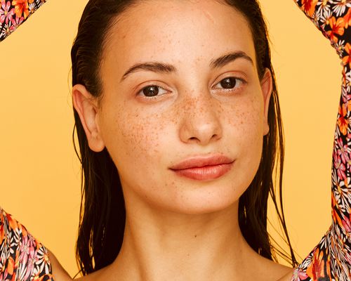 Closeup of person with clear skin and freckles