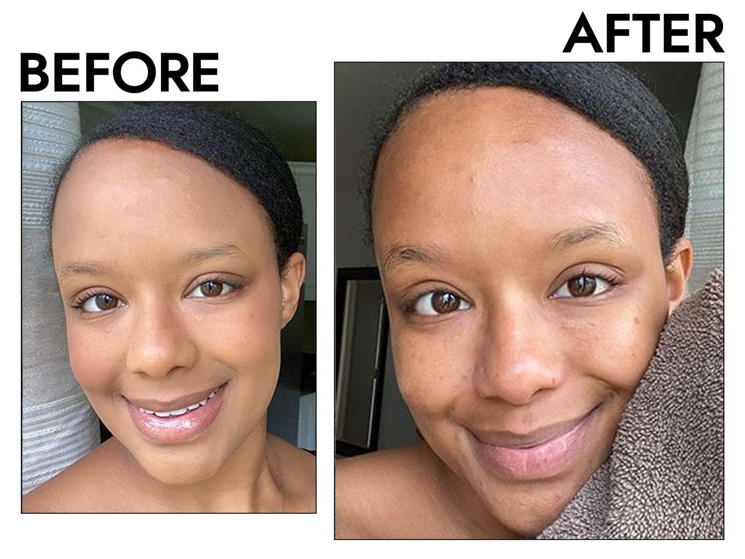 Before and after comparison of a person using cleansing oil on their skin 