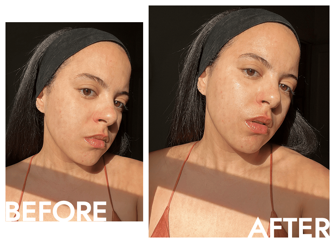 Byrdie editor Star Donaldson's skin before and after applying the Charlotte Tilbury Magic Water Cream