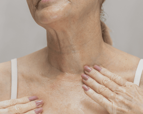 A close up of a models neck skin, with wrinkles and creases. 