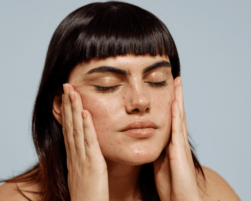 Model with medium length brown hair, blunt bangs, and freckles holding her face.