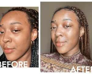 Janiah McKelton before and after using Clinique Clarifying Do-Over Peel