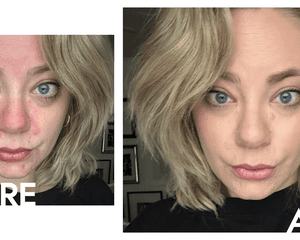 Woman before and after applying Makeup by Mario SurrealSkin Awakening Concealer