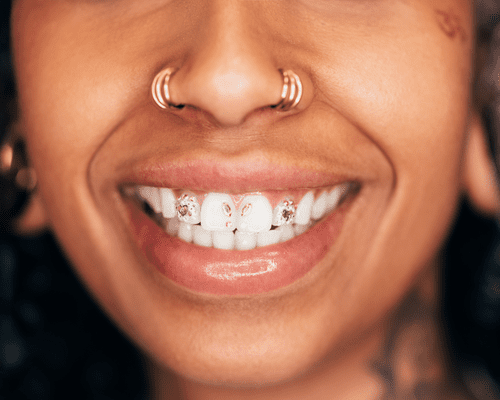 A woman from the nose down with hoop piercings on each nostril and tooth gems